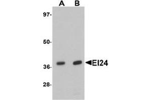 Western blot analysis of EI24 in rat liver tissue lysate with EI24 antibody at (A) 1 and (B) 2 ug/mL. (EI24 anticorps  (C-Term))