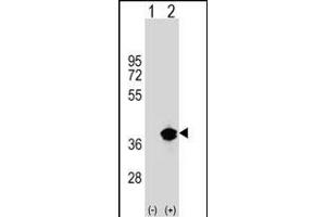 Western blot analysis of T1 (arrow) using rabbit polyclonal T1 Antibody (Center) (ABIN1538005 and ABIN2848794). (PPT1 anticorps  (AA 189-217))