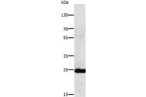 Western Blot analysis of Mouse lung tissue using RALB Polyclonal Antibody at dilution of 1:250 (RALB anticorps)