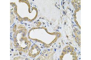 Immunohistochemistry of paraffin-embedded Human kidney using ICOSL Polyclonal Antibody at dilution of 1:100 (40x lens). (ICOSLG anticorps)