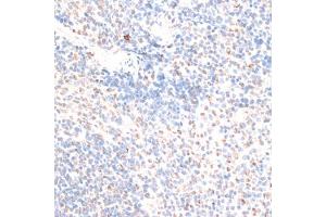 Immunohistochemistry of paraffin-embedded mouse spleen using HMGN1 antibody.