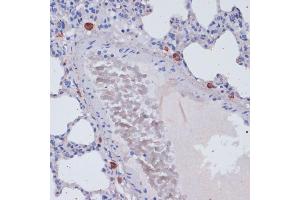 Immunohistochemistry of paraffin-embedded rat lung using Perforin antibody (ABIN3020641, ABIN3020642, ABIN3020643 and ABIN6213612) at dilution of 1:100 (40x lens). (Perforin 1 anticorps  (AA 280-555))