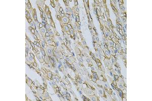 Immunohistochemistry of paraffin-embedded mouse stomach using AP2B1 Antibody (ABIN5971039) at dilution of 1/100 (40x lens). (AP2B1 anticorps)