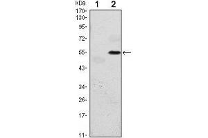 Western Blot showing EIF2AK3 antibody used against HEK293 (1) and EIF2AK3 (AA: 929-1116)-hIgGFc transfected HEK293 (2) cell lysate. (PERK anticorps)