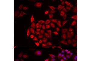 Immunofluorescence analysis of HeLa cells using COCH Polyclonal Antibody (COCH anticorps)