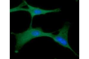 ICC/IF analysis of PGK1 in U87MG cells line, stained with DAPI (Blue) for nucleus staining and monoclonal anti-human PGK1 antibody (1:100) with goat anti-mouse IgG-Alexa fluor 488 conjugate (Green).