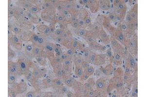 IHC-P analysis of Human Liver Tissue, with DAB staining. (Asialoglycoprotein Receptor 1 anticorps  (AA 77-289))