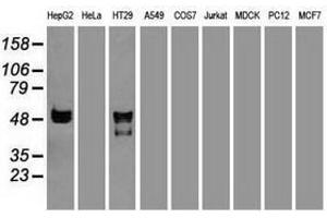 Image no. 2 for anti-serpin Peptidase Inhibitor, Clade A (Alpha-1 Antiproteinase, Antitrypsin), Member 1 (SERPINA1) (AA 26-418) antibody (ABIN1491294) (SERPINA1 anticorps  (AA 26-418))