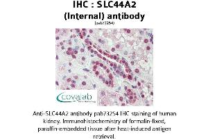 Image no. 1 for anti-Solute Carrier Family 44, Member 2 (SLC44A2) (Internal Region) antibody (ABIN1739381) (SLC44A2 anticorps  (Internal Region))