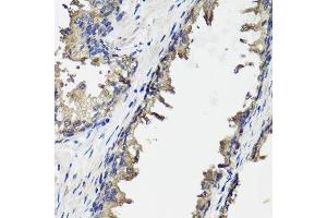 Immunohistochemistry of paraffin-embedded human prostate using OTC antibody. (OTC anticorps  (AA 215-354))
