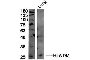 Mouse lung lysates probed with Rabbit Anti-HLA DM Polyclonal Antibody, Unconjugated  at 1:300 overnight at 4˚C. (HLA-DM anticorps  (AA 101-200))