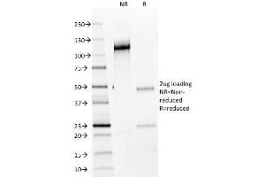 SDS-PAGE Analysis Purified NKX2.