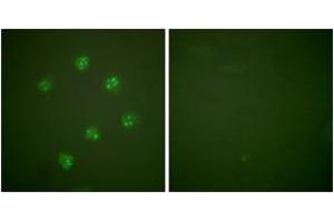 Immunofluorescence (IF) image for anti-Antigen Identified By Monoclonal Antibody Ki-67 (MKI67) (AA 3207-3256) antibody (ABIN2889217) (Ki-67 anticorps  (AA 3207-3256))