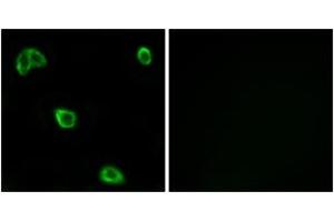 Immunofluorescence analysis of LOVO cells, using OR10K1/10K2 Antibody. (OR10K1/K2 anticorps  (AA 56-105))