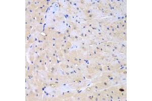 Immunohistochemistry of paraffin-embedded mouse heart using ARHGEF9 antibody (ABIN5975759) at dilution of 1/100 (40x lens).