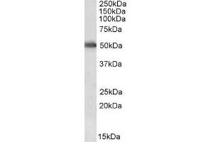 ABIN571239 (0. (CYP2E1 anticorps  (Internal Region))
