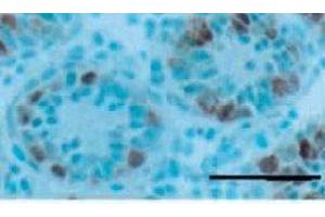 Western Blotting (WB) image for anti-Gena antibody (ABIN3201020) (Gena anticorps)