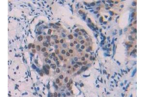 Detection of Ab1-42 in Human Lung Tissue using Monoclonal Antibody to Amyloid Beta Peptide 1-42 (Ab1-42)