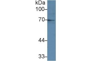 Detection of IL1R1 in Human Raji cell lysate using Polyclonal Antibody to Interleukin 1 Receptor Type I (IL1R1)