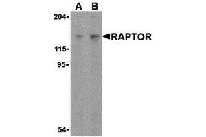 Western Blotting (WB) image for anti-RAPTOR (RAPTOR) (C-Term) antibody (ABIN1030614) (RAPTOR anticorps  (C-Term))
