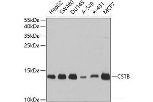 Western blot analysis of extracts of various cell lines using CSTB Polyclonal Antibody at dilution of 1:1000. (CSTB anticorps)