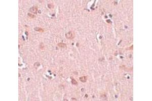 Immunohistochemical staining of human liver tissue with 5 ug/mL PLEKHM2 polyclonal antibody . (PLEKHM2 anticorps  (C-Term))