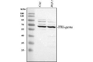 Western blot analysis of PPAR gamma using anti-PPAR gamma antibody (ABIN5518944).