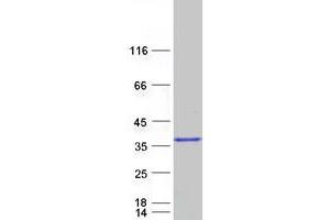 Validation with Western Blot