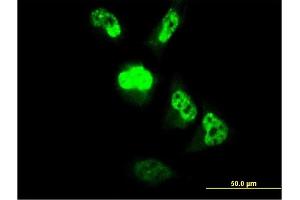 Immunofluorescence of monoclonal antibody to MGC861 on HeLa cell.