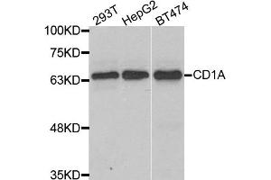 Western blot analysis of extracts of various cell lines, using CD1A antibody. (CD1a anticorps)