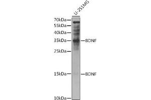 Western blot analysis of extracts of U-251MG cells, using BDNF antibody (ABIN6129991, ABIN6137522, ABIN6137524 and ABIN6215043) at 1:1000 dilution. (BDNF anticorps  (AA 20-247))