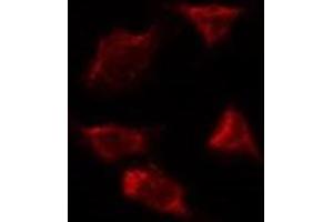 ABIN6277505 staining Hela by IF/ICC. (AIMP1 anticorps  (Internal Region))