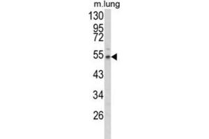 Western Blotting (WB) image for anti-Fibulin 3 (FBLN3) antibody (ABIN3004030)