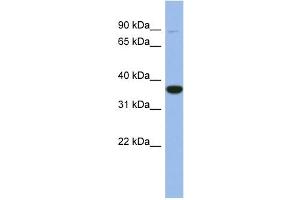 WB Suggested Anti-FANCL Antibody Titration: 0. (FANCL anticorps  (Middle Region))