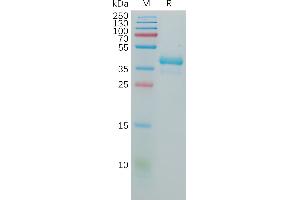 Human GNRHR Protein, hFc Tag on SDS-PAGE under reducing condition.