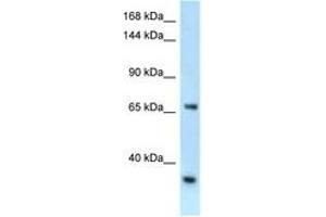 Image no. 1 for anti-RNA Binding Motif Protein 15B (RBM15B) (AA 606-655) antibody (ABIN6747437) (RBM15B anticorps  (AA 606-655))