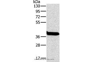 Western blot analysis of Mouse liver tissue, using OTC Polyclonal Antibody at dilution of 1:800 (OTC anticorps)
