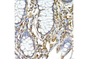 Immunohistochemistry of paraffin-embedded human colon using TNF Rabbit pAb (ABIN3022984, ABIN3022985, ABIN3022986 and ABIN6219332) at dilution of 1:50 (40x lens).