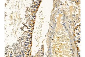ABIN6258281 and ABIN6275236 at 1/100 staining rat testis tissue by IHC-P. (MRPS27 anticorps  (N-Term))
