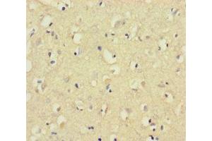 Immunohistochemistry of paraffin-embedded human brain tissue using ABIN7148826 at dilution of 1:100 (CNGA4 anticorps  (AA 1-575))