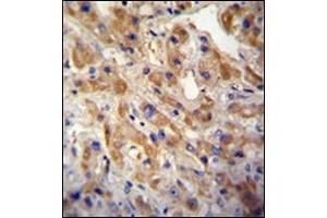 Immunohistochemistry (IHC) image for anti-Met Proto-Oncogene (MET) (Catalytic Domain) antibody (ABIN356340) (c-MET anticorps  (Catalytic Domain))
