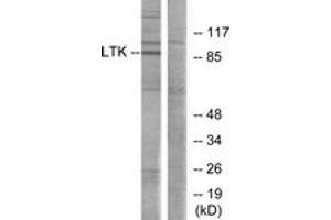 Western blot analysis of extracts from Jurkat cells, using LTK Antibody. (LTK anticorps  (AA 206-255))
