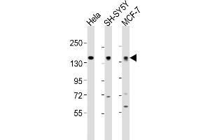 All lanes : Anti-ML2 Antibody (Center) at 1:2000 dilution Lane 1: Hela whole cell lysates Lane 2: SH-SY5Y whole cell lysates Lane 3: MCF-7 whole cell lysates Lysates/proteins at 20 μg per lane. (MAML2 anticorps  (AA 780-814))
