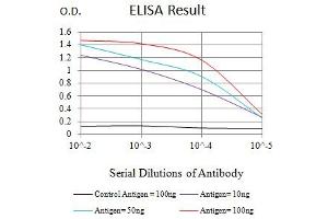 Black line: Control Antigen (100 ng),Purple line: Antigen (10 ng), Blue line: Antigen (50 ng), Red line:Antigen (100 ng) (CD7 anticorps  (AA 26-180))