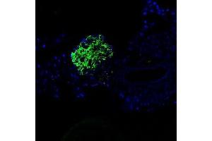 Mouse Pancreas (C57BL/6 strain) fixed in 4% PFA for 2 hours at RT, then transferred to 30% sucrose overnight at 4°C before embedding in OCT mounting medium.