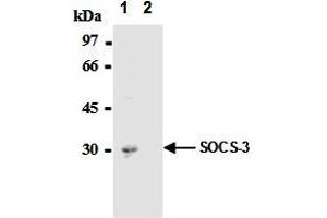 Immunoprecipitation of SOCS-3 from mouse hepatocytes with AM26562AF-N  or mouse IgG1  After immunoprecipitated with the antibody, immunocomplex was resolved on SDS-PAGE and immunoblotted with biotinylated anti-SOCS-3 monoclonal antibody. (SOCS3 anticorps  (AA 2-44))