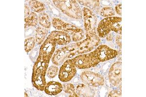 Immunohistochemistry of paraffin-embedded rat kidney using WRB Rabbit pAb (ABIN6129154, ABIN6150261, ABIN6150262 and ABIN6222768) at dilution of 1:250 (40x lens). (WRB anticorps  (AA 30-100))