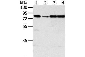 Western Blot analysis of Jurkat, hepg2, Raji and A431 cell using TAF15 Polyclonal Antibody at dilution of 1:450 (TAF15 anticorps)