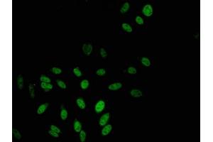 Immunofluorescent analysis of Hela cells using ABIN7152455 at dilution of 1:100 and Alexa Fluor 488-congugated AffiniPure Goat Anti-Rabbit IgG(H+L)