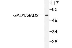 Image no. 2 for anti-Glutamate Decarboxylase 1 (Brain, 67kDa) (GAD1) antibody (ABIN271888) (GAD anticorps)